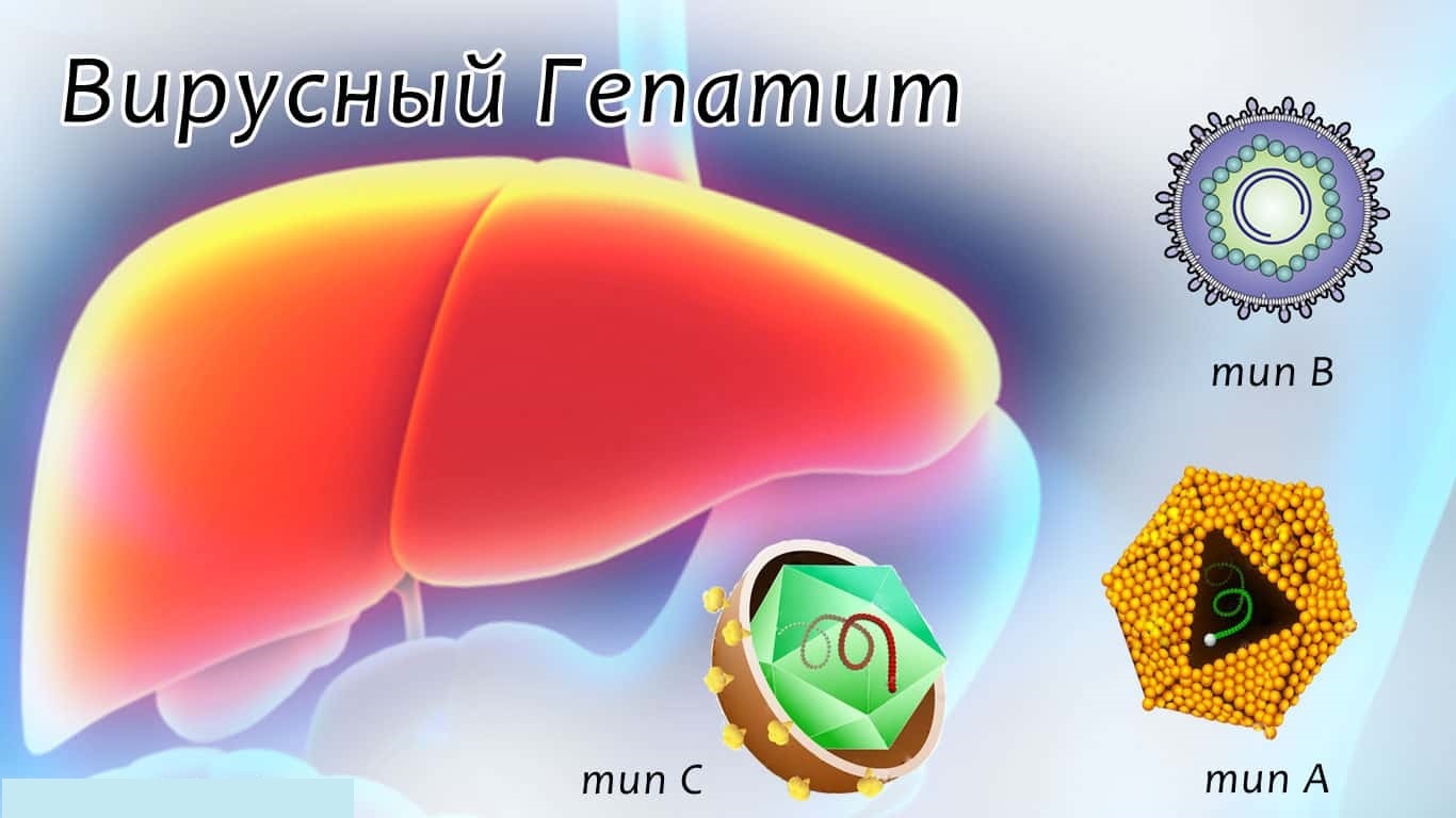 Гепатит а картинки для презентации